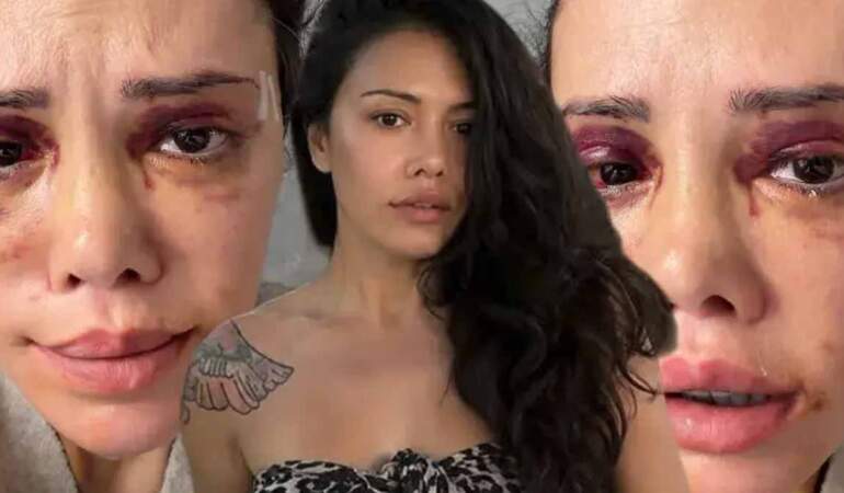 Survivor Didem Ceran’dan ağlatan açıklama: “Beni CİMER’e şikayet etmişler”