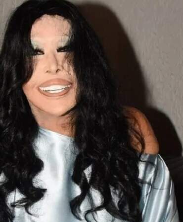 Bülent Ersoy estetik yaptırdı! 74 yaşında ‘Yüzümü Lolita gibi yaptırdım’ dedi