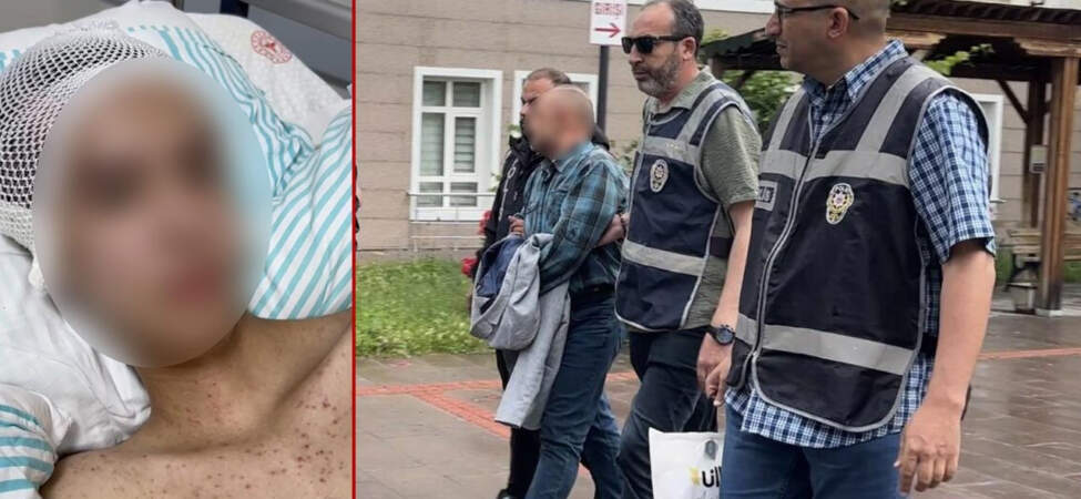 İstismara Direnen 14 Yaşındaki Çocuğu Öldürmeye Kalktı: Komadan Uyanan Çocuk Her Şeyi Anlattı