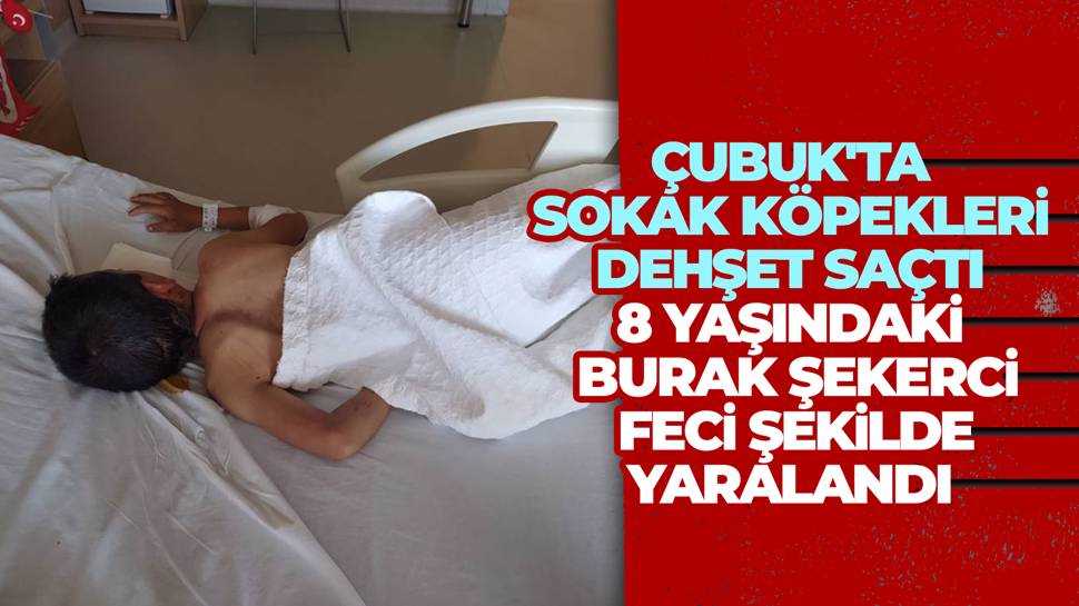 Ankara’da Köpek Saldırısı! Burak Şekerci Hastanelik Oldu