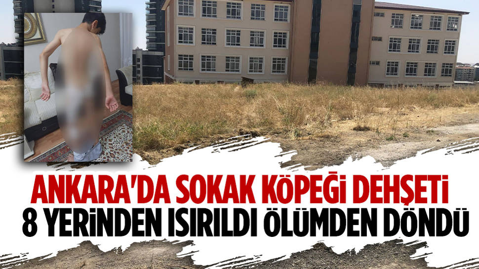 Sokak Köpeklerinin Saldırdığı Çocuk Ölümden Döndü