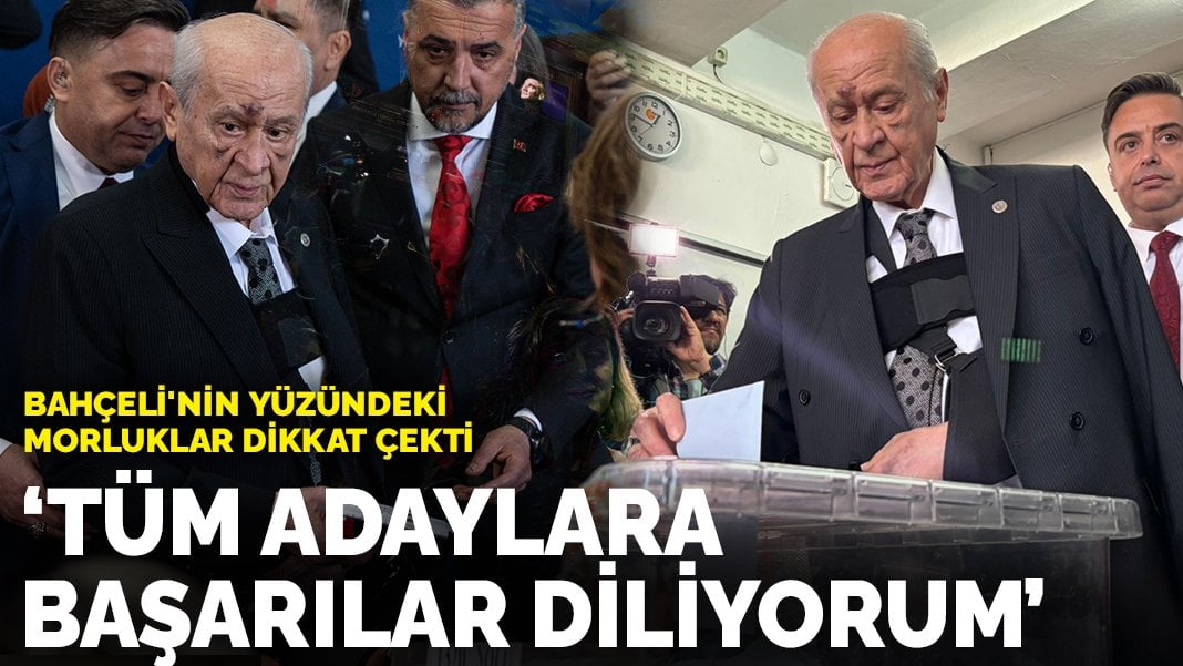 Bahçeli oyunu kullandı: Yüzündeki morluklar dikkat çekti