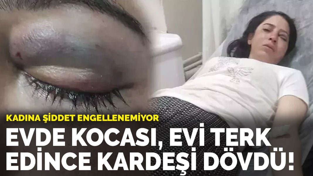 Kadına şiddet engellenemiyor! Evde kocası, evi terk edince kardeşi dövdü!