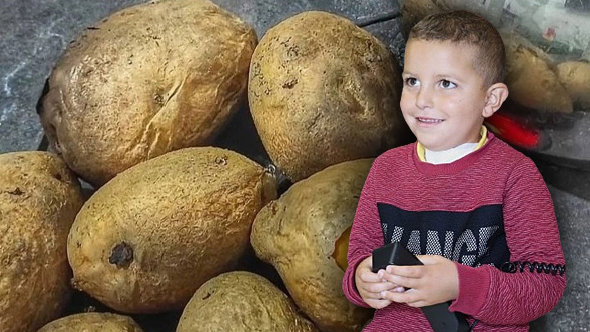 Haşlanmış patates yiyen çocuk krize girdi: Günlerce komada kaldı! Çocuğunuzu sakın böyle beslemeyin