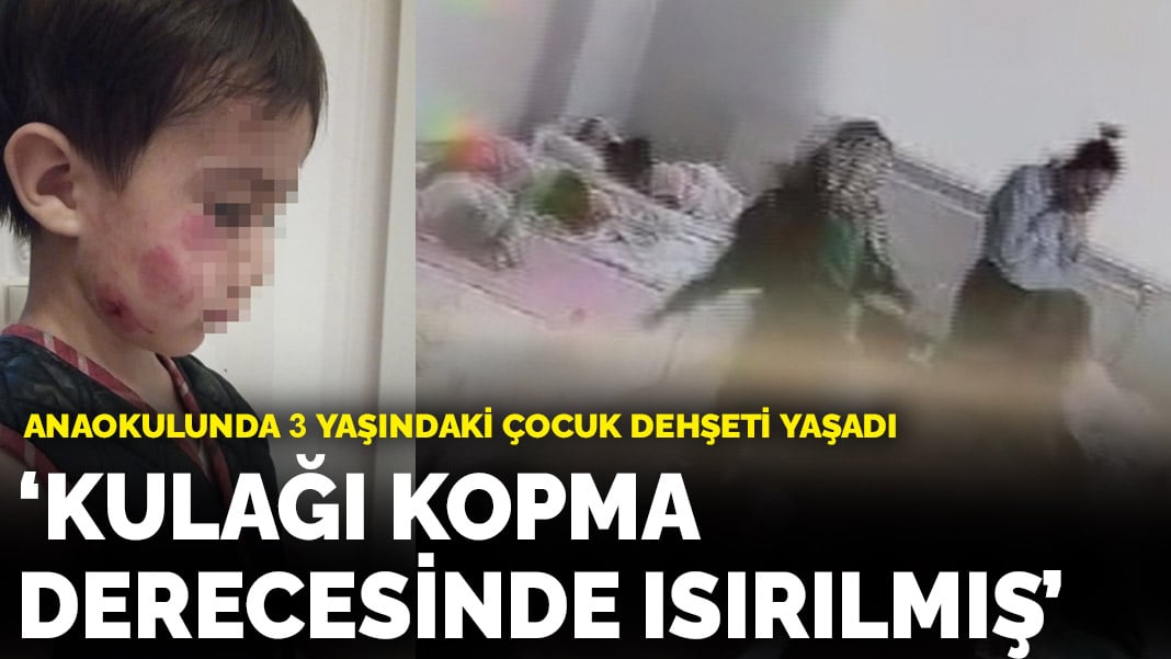 Konya’da anaokulunda dehşet! ‘Kulağı kopma derecesinde ısırılmış’