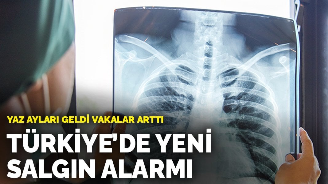 Yaz ayları geldi vakalar arttı: Türkiye’de yeni salgın alarmı