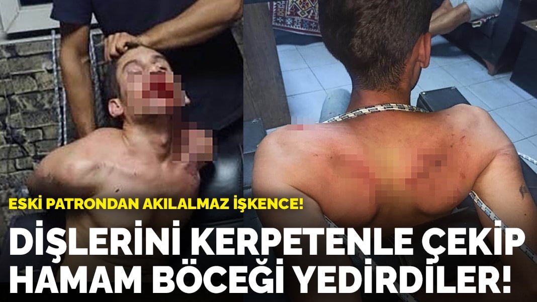 Akılalmaz işkence! Dişlerini kerpetenle çekip hamam böceği yedirdiler