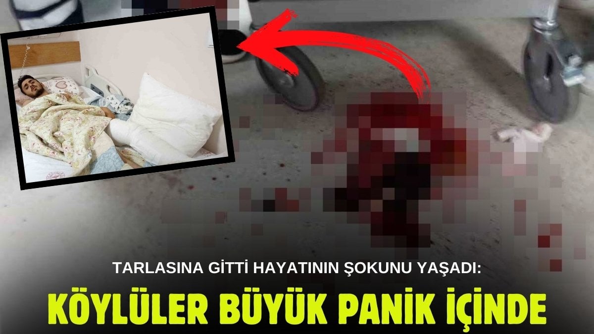 Tarlasını sulamak için giden çiftçi karşısında görünce şok oldu! Bacağından 15 cm’lik dişini çıkardılar