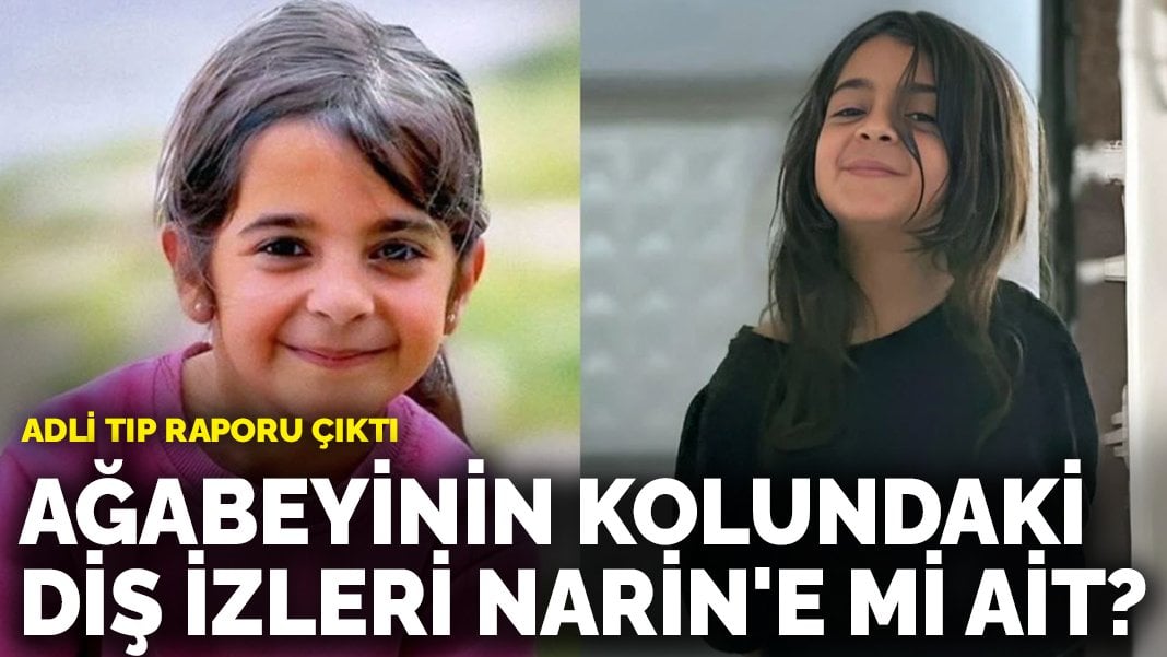 Adli tıp raporu çıktı: Ağabeyinin kolundaki diş izleri Narin’e mi ait?