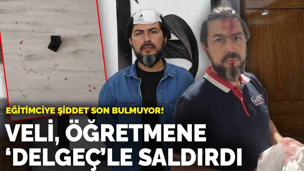 Eğitimciye şiddet son bulmuyor! Veli, öğretmeni ‘delgeç’le saldırdı