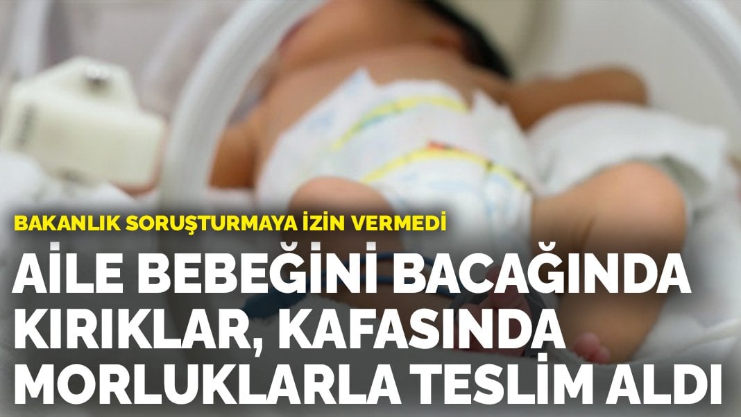 Aile bebeğini bacağında kırıklar, kafasında morluklarla teslim aldı: Bakanlık soruşturmaya izin vermedi