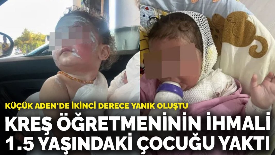 Kreş öğretmeninin ihmali 1.5 yaşındaki çocuğu yaktı: Küçük Aden’de ikinci derece yanık oluştu