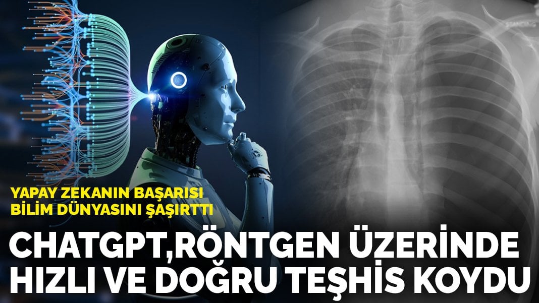 Yapay zekanın başarısı bilim dünyasını şaşırttı: ChatGPT, röntgen üzerinde hızlı ve doğru teşhis koydu