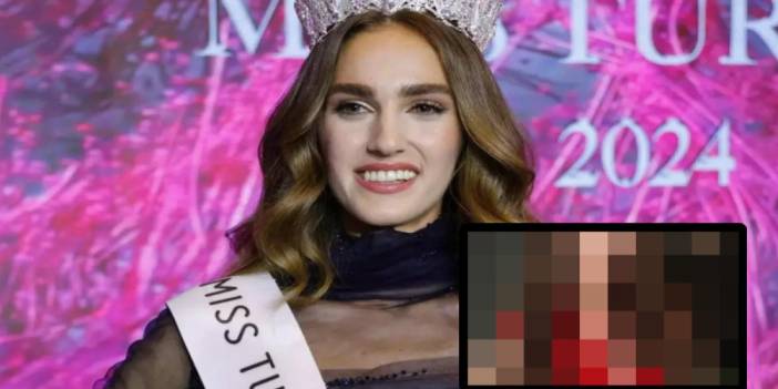 Şabaniye'ye benzetilmişti! İdil Bilgen estetik mi yaptırdı? Son halini görenler şok oldu