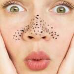 Siyah noktaları temizlemenin en ekonomik ve doğal yolu: Bu maske tarifini bir kez deneyen bir daha bırakamıyor!