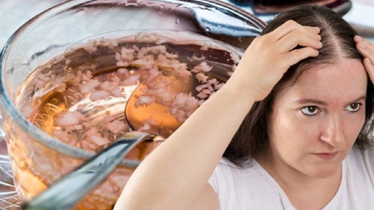 Saçları rapunzel gibi uzatıyor, saç sorunlarını ortadan kaldırıyor! Ne kepek ne de kaşıntı… Hepsi anında yok oluyor