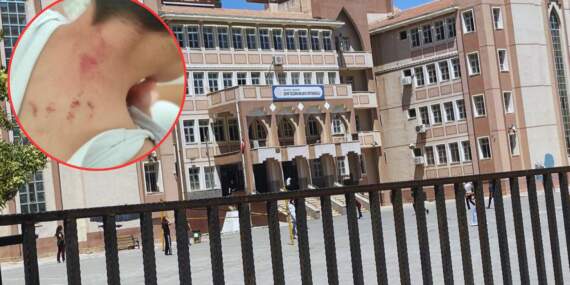 Öğretmen, 10 Yaşındaki Öğrencisine Dehşeti Yaşattı: Darp Raporu Alındı, Tutuklandı