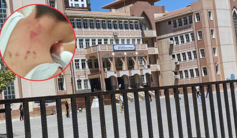 Öğretmen, 10 Yaşındaki Öğrencisine Dehşeti Yaşattı: Darp Raporu Alındı, Tutuklandı