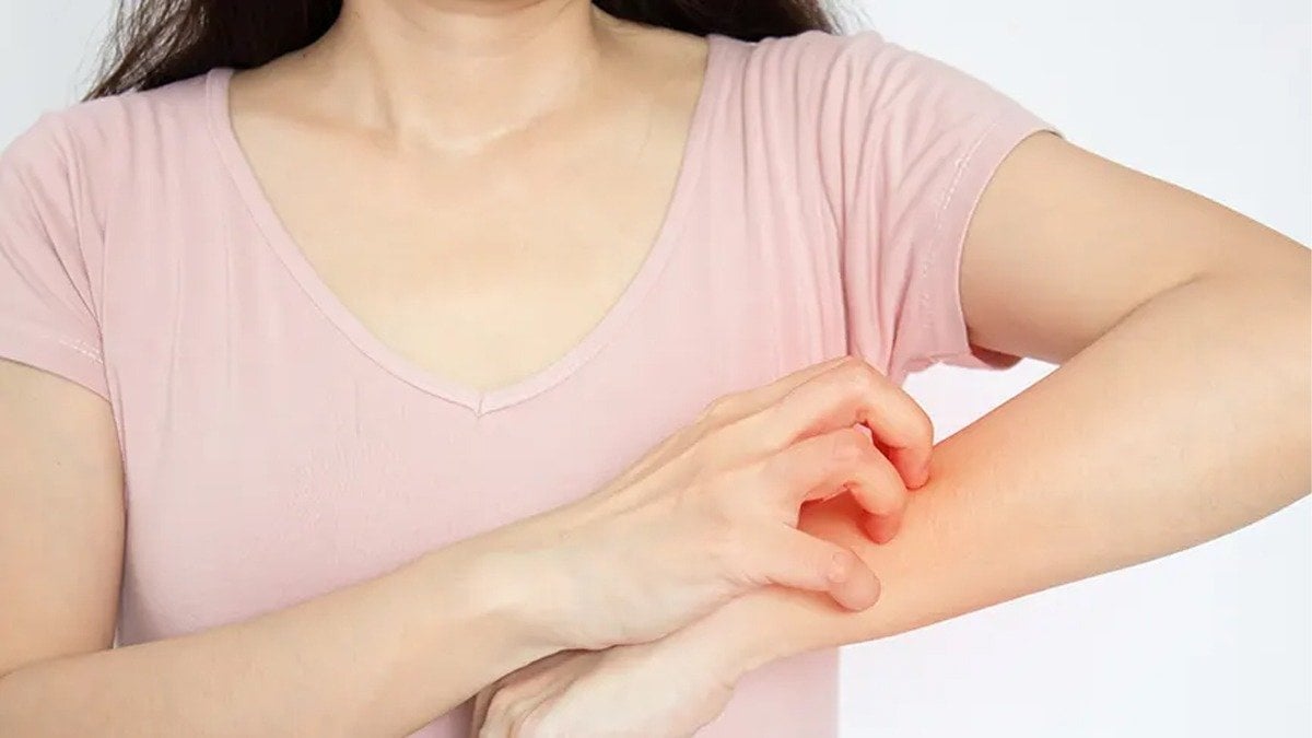 Böcekleri düşününce bile kaşınıyor musunuz? Bilim insanları bu soruya cevap buldu