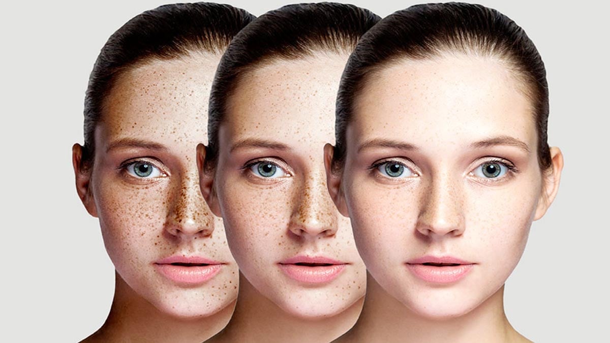 Yüzdeki güneş lekeleri, ellerdeki yaşlılık izleri tarih oluyor! Sadece 3 malzemeyle hazırlanan mucize maskeye herkes bayılıyor