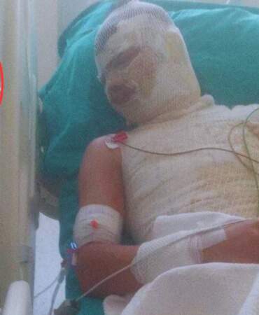 Adana’da 16 Yaşındaki Yeğenini Diri Diri Yakmıştı: Dehşet Saniye Saniye Kamerada