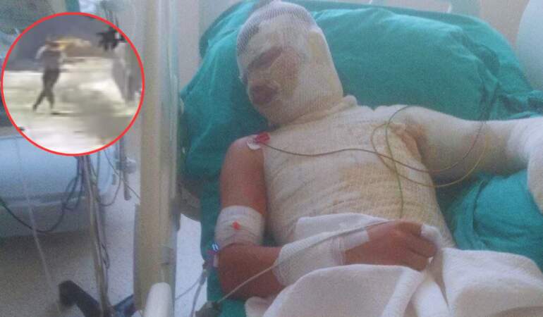 Adana’da 16 Yaşındaki Yeğenini Diri Diri Yakmıştı: Dehşet Saniye Saniye Kamerada