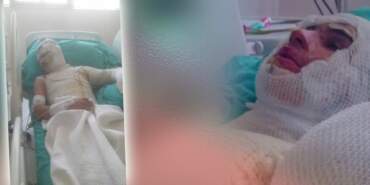 Adana’da Korkunç ‘Amca’ Dehşeti! 16 Yaşındaki Yeğenini Yaktı, O da Yetmedi Suçu Ağabeyinin Üstüne Attı