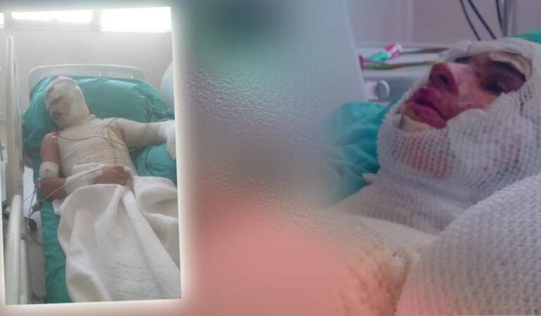 Adana’da Korkunç ‘Amca’ Dehşeti! 16 Yaşındaki Yeğenini Yaktı, O da Yetmedi Suçu Ağabeyinin Üstüne Attı