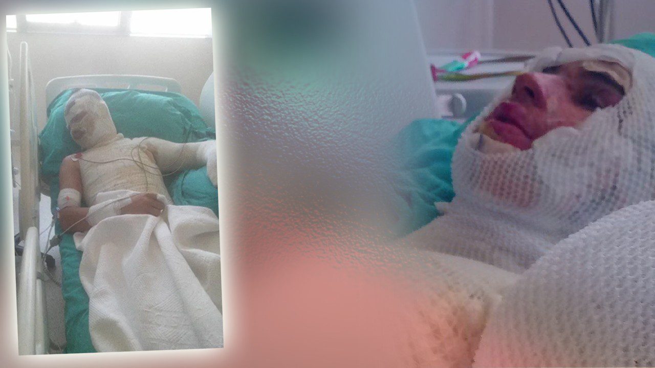 Adana’da Korkunç ‘Amca’ Dehşeti! 16 Yaşındaki Yeğenini Yaktı, O da Yetmedi Suçu Ağabeyinin Üstüne Attı