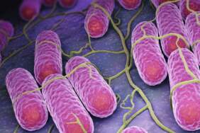 Öldüren Kumpirden Sonra Bir Gıdada Daha Alarm! İçinden Salmonella Çıktı