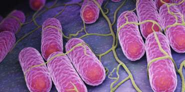 Öldüren Kumpirden Sonra Bir Gıdada Daha Alarm! İçinden Salmonella Çıktı