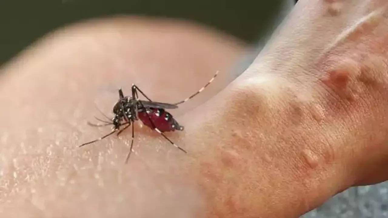 Sineklerin En Çok Isırdığı Saatler Açıklandı! Bu Saatlerde Dışarı Çıkmayın