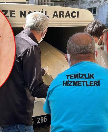 Sivas’ta Kene Kaynaklı Bir Ölüm Daha… Toplam Can Kaybı 10’a Çıktı