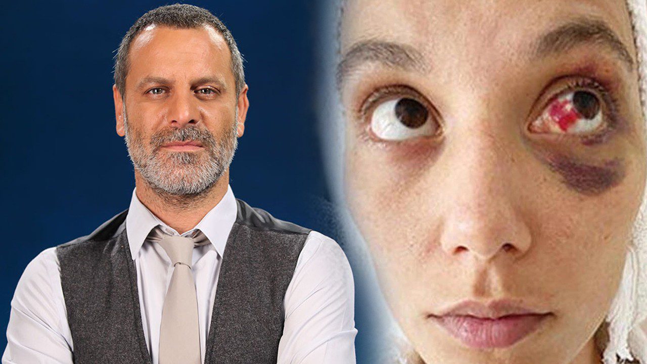 Ünlü Oyuncu Ozan Güven’e Hapis Cezası