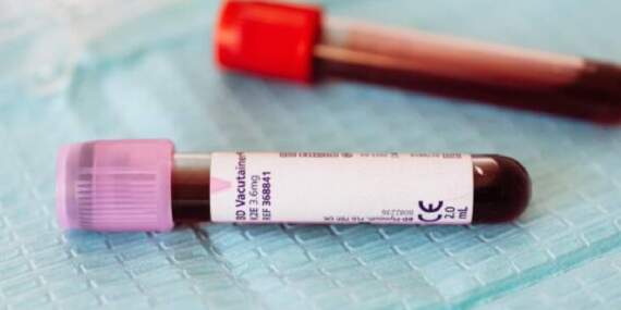Yeni Kan Grubu Ortaya Çıktı: Dünyada Sadece 1 Kişide Görüldü