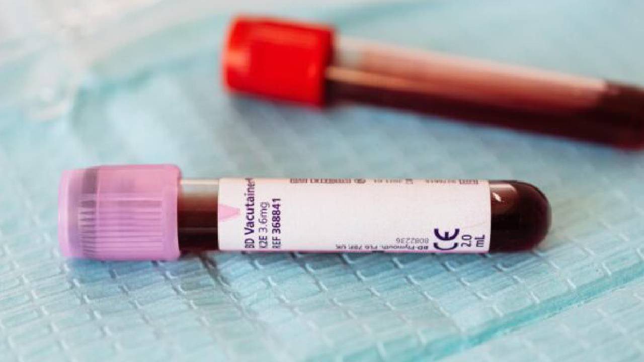 Yeni Kan Grubu Ortaya Çıktı: Dünyada Sadece 1 Kişide Görüldü