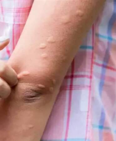 Ne kolonya ne kimyasal! Her evde olan bu mucize sineği kaçırıyor: Babaannelerin sandıkta kalan yöntemi