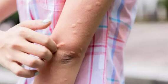 Ne kolonya ne kimyasal! Her evde olan bu mucize sineği kaçırıyor: Babaannelerin sandıkta kalan yöntemi