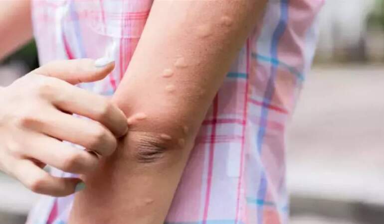 Ne kolonya ne kimyasal! Her evde olan bu mucize sineği kaçırıyor: Babaannelerin sandıkta kalan yöntemi