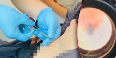 Halsizlik Şikayetiyle Hastaneye Gitti, Karnından Çıkanla Şoke Oldu