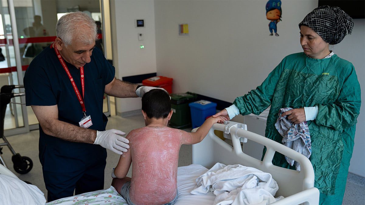 Güneşte saatlerce kalan küçük çocuk hastanelik oldu: ‘Krem sürmeyi unuttuk’