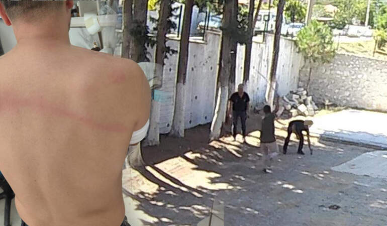 Belediye Başkanı Erkan Hayla Zabıtanın Sırtında Sopa Kırdı: Dehşet Anları Saniye Saniye Kaydedildi