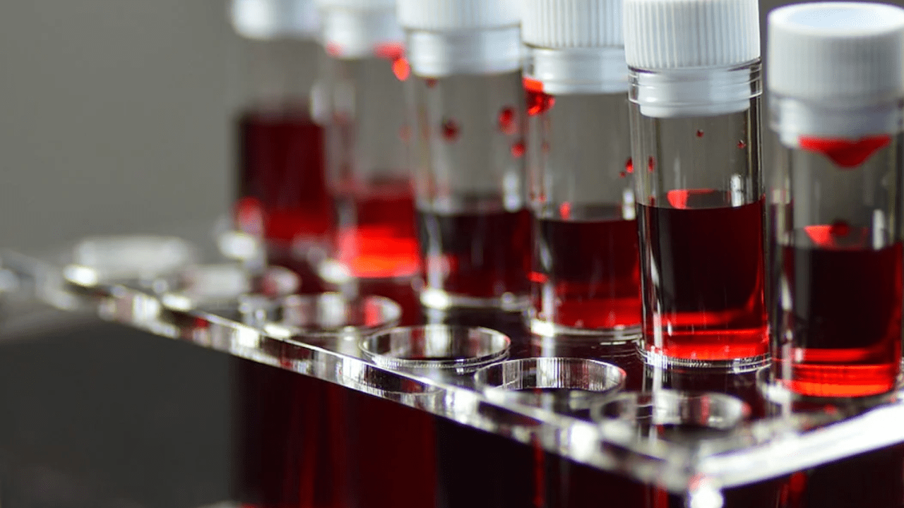 Dünyada Sadece Bir Kişide Görülen Yeni Kan Grubu Keşfedildi