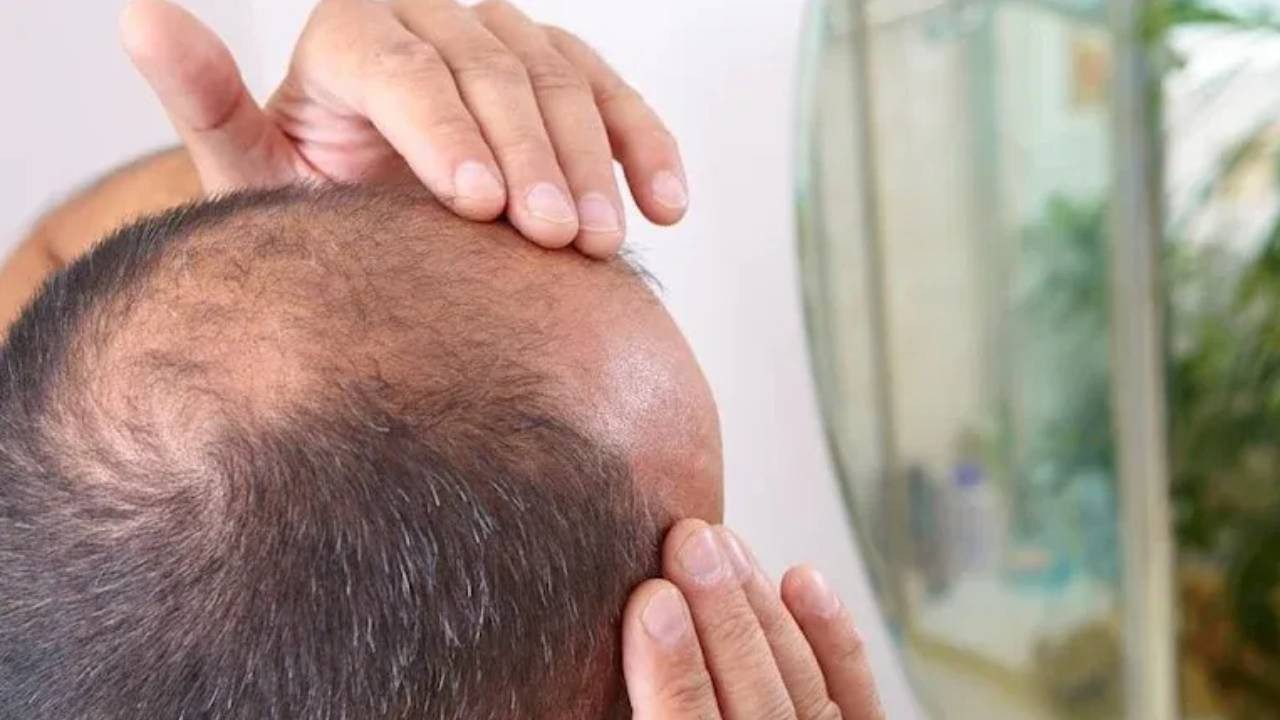 İçmeden Önce Bir Kez Daha Düşünün! Bu İçecekler Kel Yapıyor