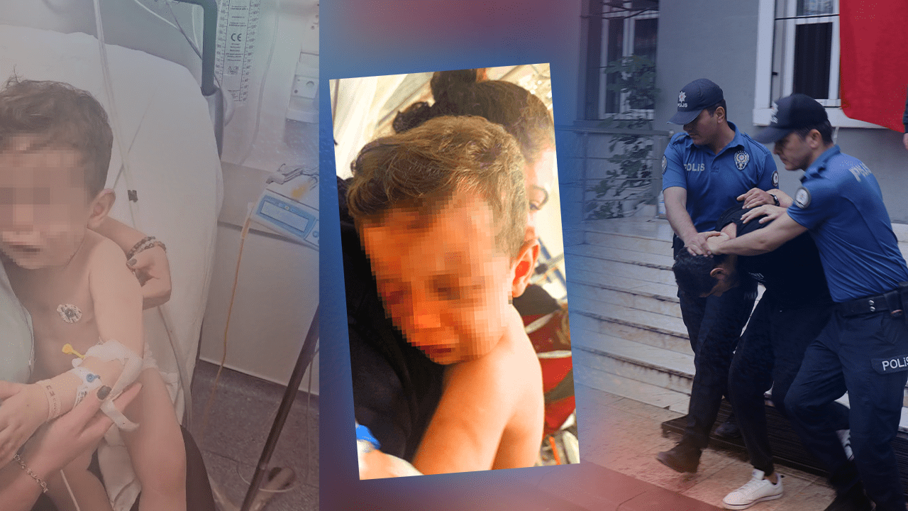 Mosmor Bir Beden, Sigara Yanıkları, Darp İzleri… Aren Bebeğin Davasında ‘Vicdan Sızlatan Anne’ İçin Yeni Talep, Doktorlar Tek Tek Anlattı