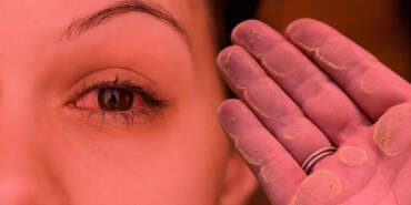 Türkiye İçin Büyük Tehlike! Etkisi 250 Kat Yükselecek, Cuma ve Cumartesi Kabusa Dönecek