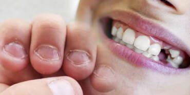 Türkiye’de Her 3 Kişiden 1’inde Görülüyor! Tırnaklardan Başlıyor, Diş Köklerini Eritiyor