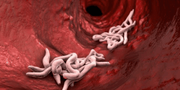 Vücuda Acısız Şekilde Nüfuz Ediyor, Gizli Gizli Kansere Götürüyor! Avrupa’da Görülmeye Başladı