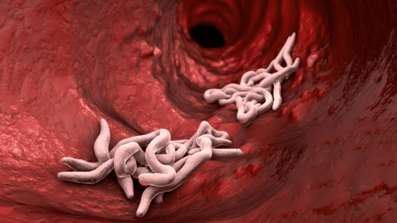 Vücuda Acısız Şekilde Nüfuz Ediyor, Gizli Gizli Kansere Götürüyor! Avrupa’da Görülmeye Başladı