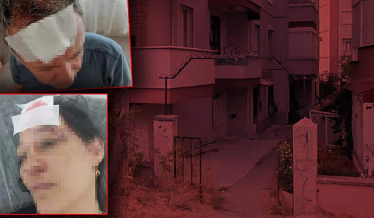 Yazlıkçı Aile Tatilde Hayatının Şokunu Yaşadı: Bayılana Kadar Demir Sopayla Darp Edildiler
